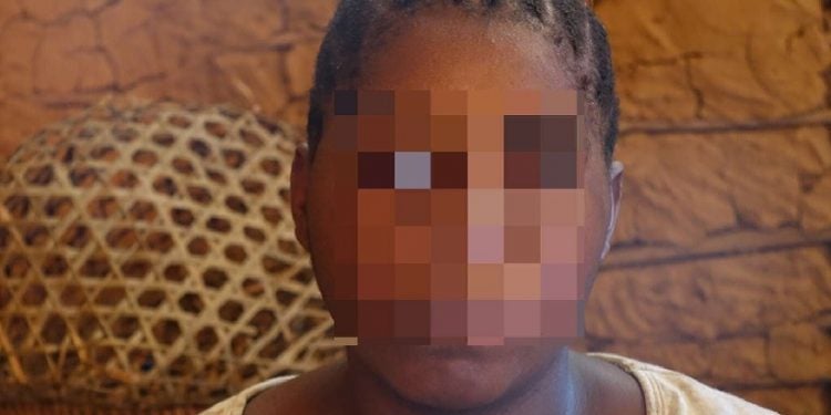Esta mulher Baka foi estuprada por um guarda florestal do African Parks. “O African Parks são pessoas muito ruins. Todo mundo que trabalha lá é muito ruim com a gente. Aquele homem foi cruel, ele foi desumano.” © Survival