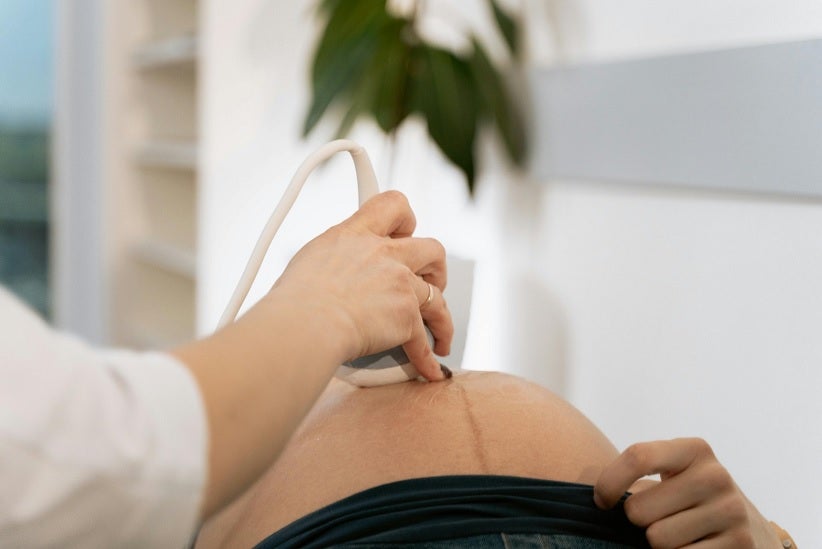 Uma das formas de diagnóstico da placenta acreta é por meio da ultrassonografia. Foto: Pexels