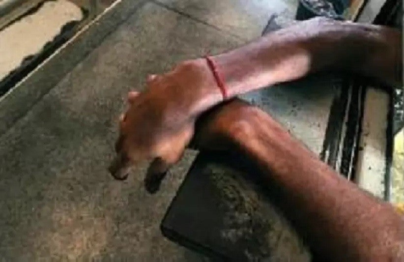 Desde 2007, mais de 150 detentos morreram nos conflitos, segundo dados da Anistia Internacional - Foto Reprodução