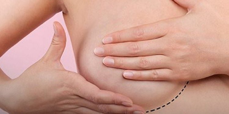Evento aborda prevenção e tratamento da doença em Foz do Iguaçu e região - imagem ilustrativa: Sociedade Brasileira de Mastologia