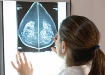 Mamografias no SUS em pacientes com menos de 50 anos representam 30% do total, equivalente a mais de 1 milhão em 2024. Foto: GettyImages