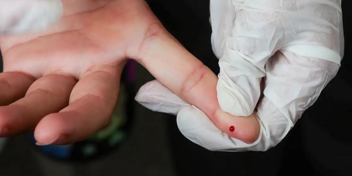 Brasil zera meta e reduz transmissão vertical de hepatite B