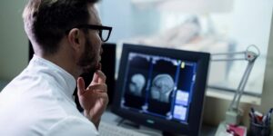 Diretriz fixa critérios para tratar AVC pediátrico na saúde