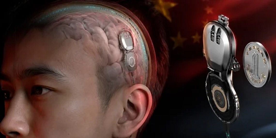 China vence Musk e realiza 1º implante de chip cerebral NEO